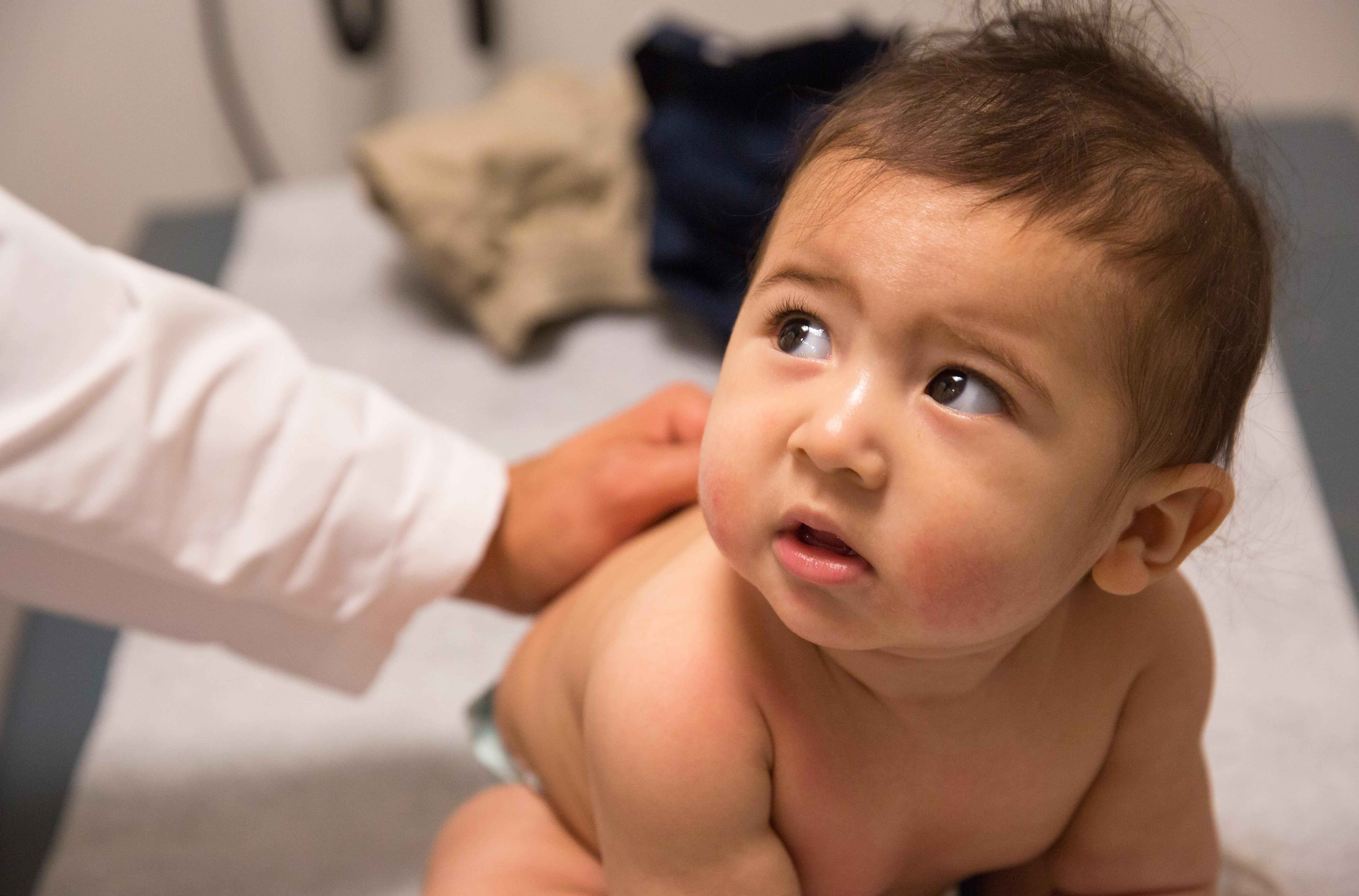 A baby looks up at a pediatrician.